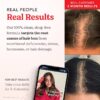 Advanced Formula Supplement for Hair Health – With Biotin, Vitamins & Antioxidants – 100% Vegan, 1-Month Supply – For Women & Men