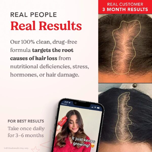 Advanced Formula Supplement for Hair Health – With Biotin, Vitamins & Antioxidants – 100% Vegan, 1-Month Supply – For Women & Men