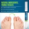 Nail Repair Pen – 25% Undecylenic Acid Toenail Fungus Treatment Extra Strength, Advanced Treatment for Damaged Nails, Nail Softener, Ingrown Toenail Support Foot Care Formula 4PCS