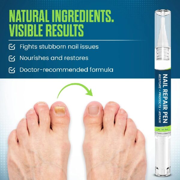 Nail Repair Pen – 25% Undecylenic Acid Toenail Fungus Treatment Extra Strength, Advanced Treatment for Damaged Nails, Nail Softener, Ingrown Toenail Support Foot Care Formula 4PCS
