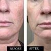 Vitamin C Serum for Face - Anti Aging & Reduce Wrinkles, Dark Spots & Sun Damage - Face Serum for Women to Enhance Collagen Level - Contains Hyaluronic Acid & Vitamin E - 1.7 Fl. Oz