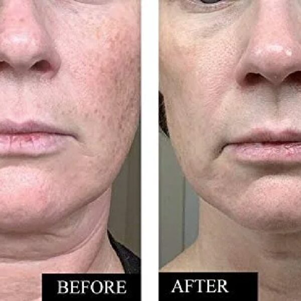 Vitamin C Serum for Face - Anti Aging & Reduce Wrinkles, Dark Spots & Sun Damage - Face Serum for Women to Enhance Collagen Level - Contains Hyaluronic Acid & Vitamin E - 1.7 Fl. Oz