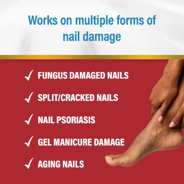 Multi-Purpose Nail Repair, Nail Solution for Discolored and Damaged Nails, 0.43 oz