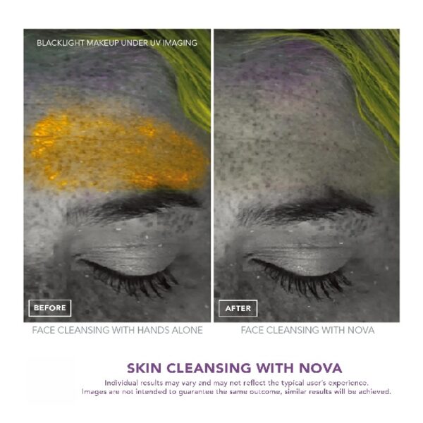 NOVA: Sonic Facial Cleansing, Exfoliating, Serum Infuser Device with Antimicrobial Brush Bristles