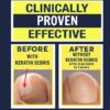 Nail Gel Restores Fungus Damaged Nails, a Clinically Proven Toenail Treatment, 90% of Nails Improve, Money-Back Guaranteed, 4 oz
