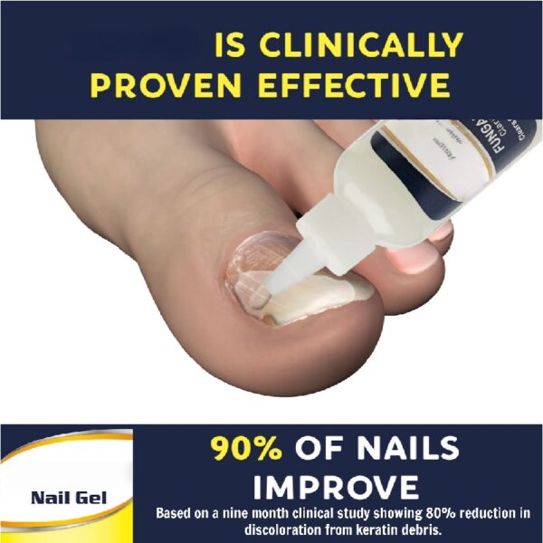 Nail Gel Restores Fungus Damaged Nails, a Clinically Proven Toenail Treatment, 90% of Nails Improve, Money-Back Guaranteed, 4 oz